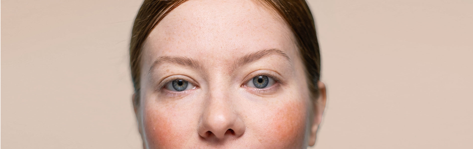 Reducing Redness How LED Light Therapy Can Soothe Rosacea Symptoms