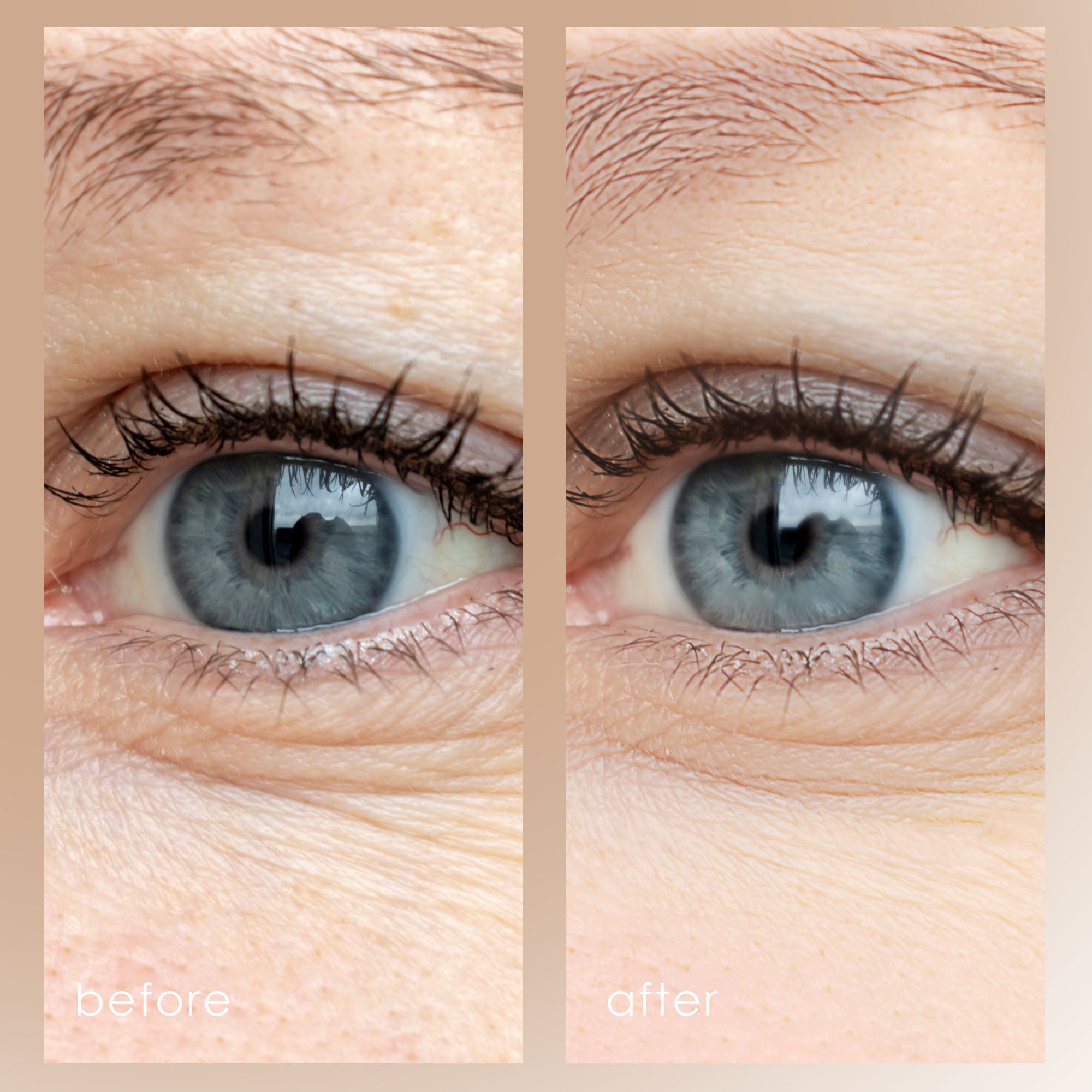 Project E Beauty Intensive Eye Repair Essence