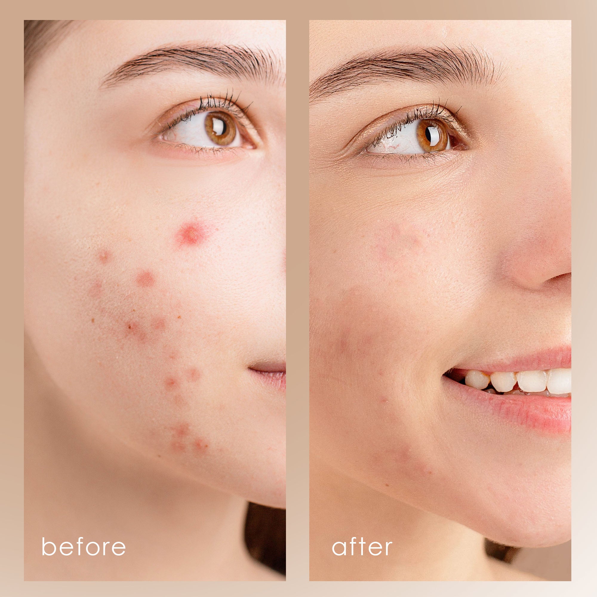 UltraGlow | Ultrasonic Skin Scrubber