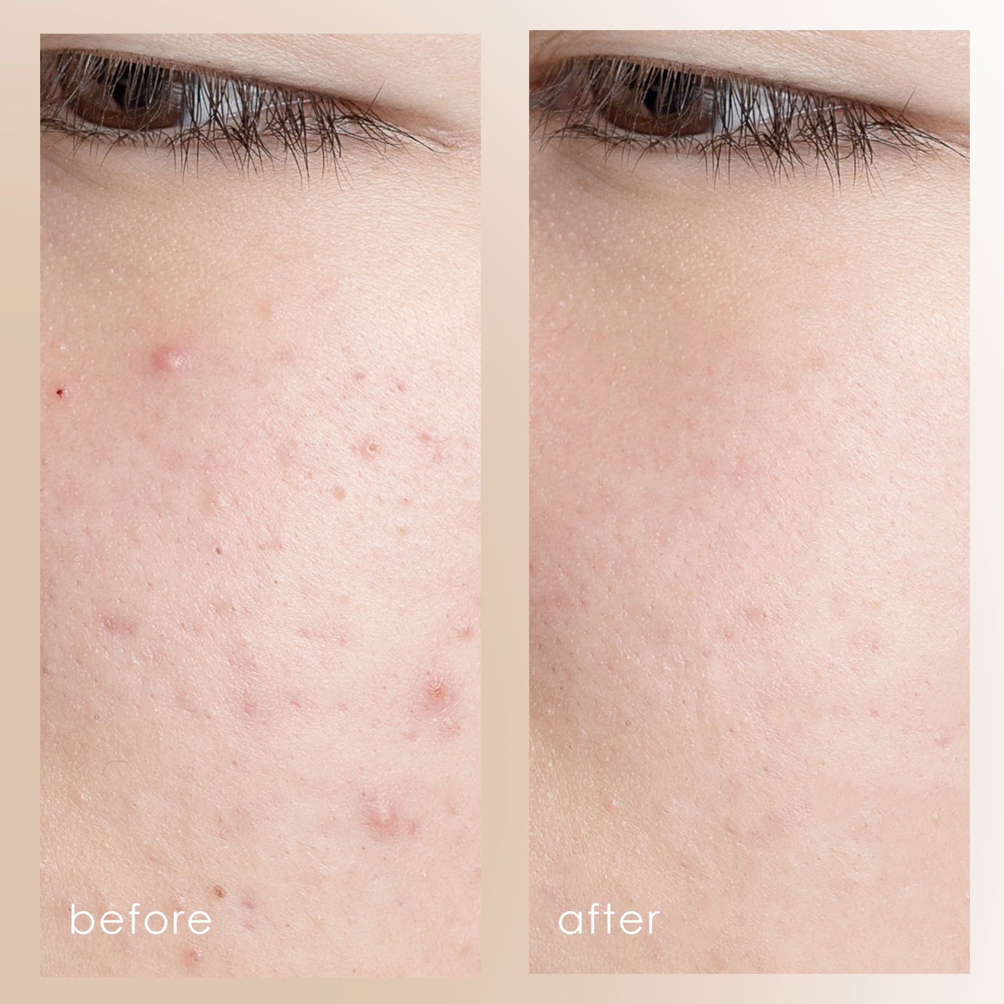 CLEO+ | Sonic Facial Cleanser