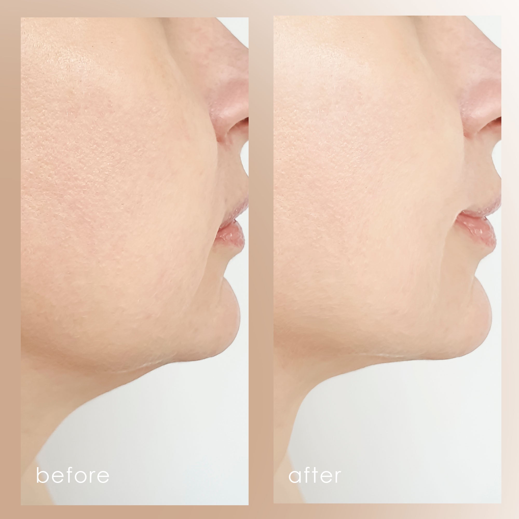 VORA Microcurrent Facial Roller