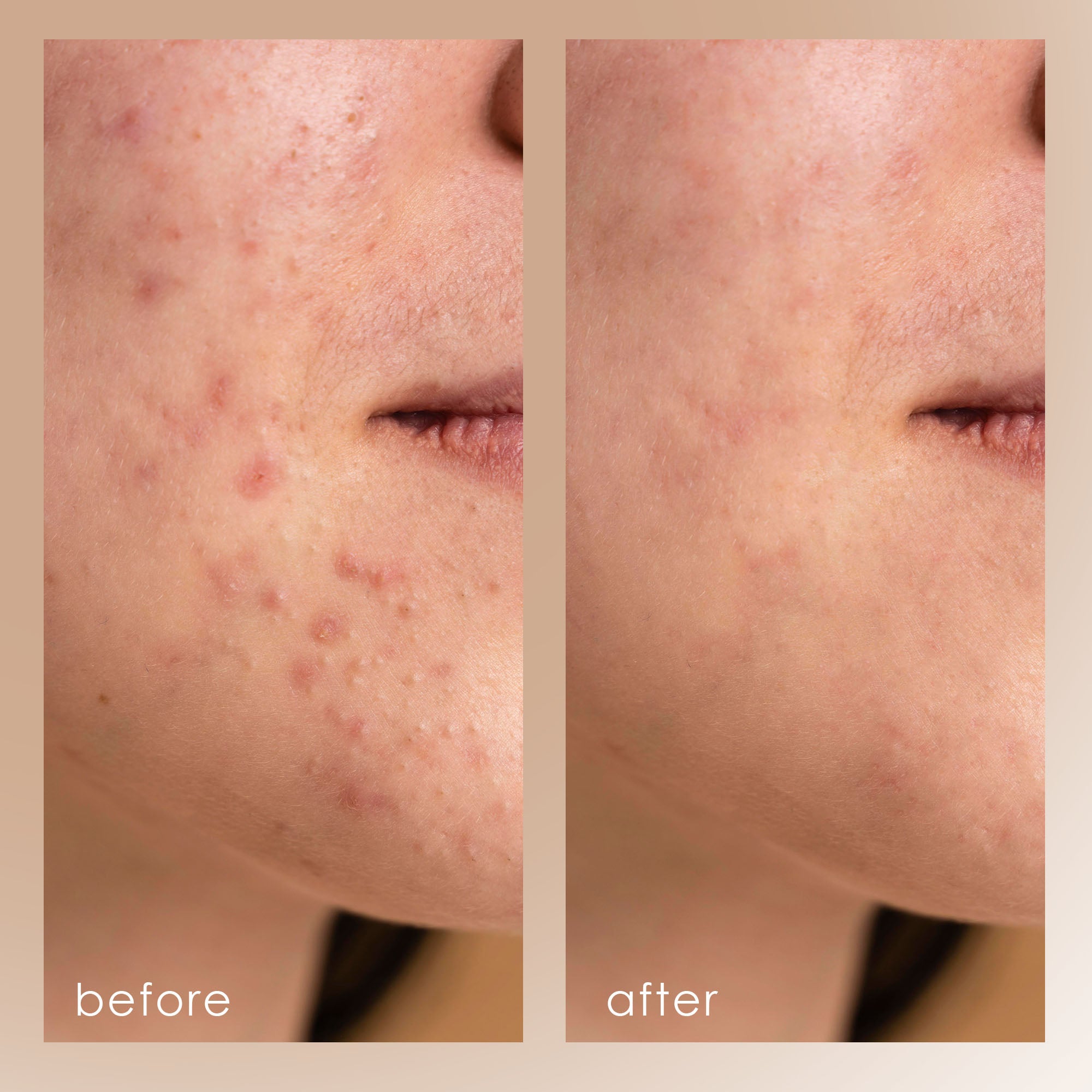 Gloa Face and Body Cleansing Brush
