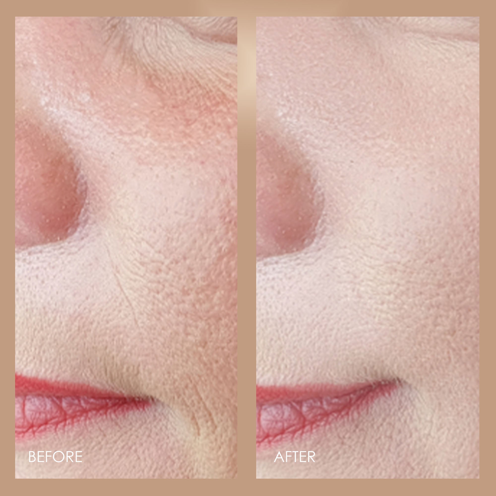 RED LED+ | Anti-Aging Therapy