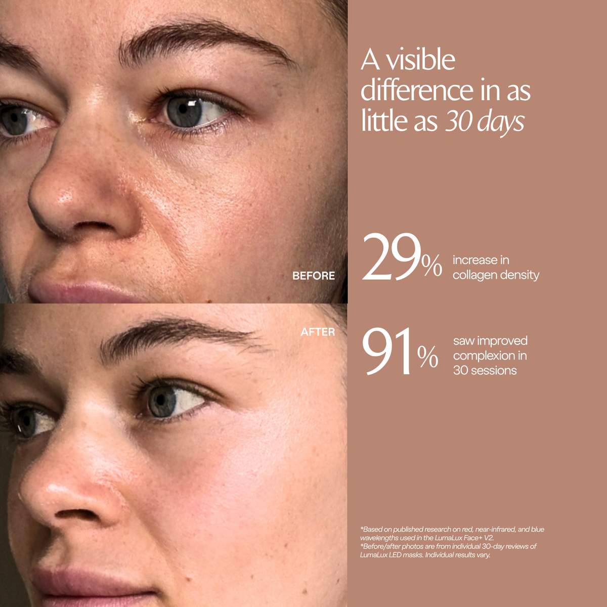 LumaLux Face+ V2 Bewertungsgrafik mit Vorher-Nachher-Gesichtsfotos und Studienprozentwerten