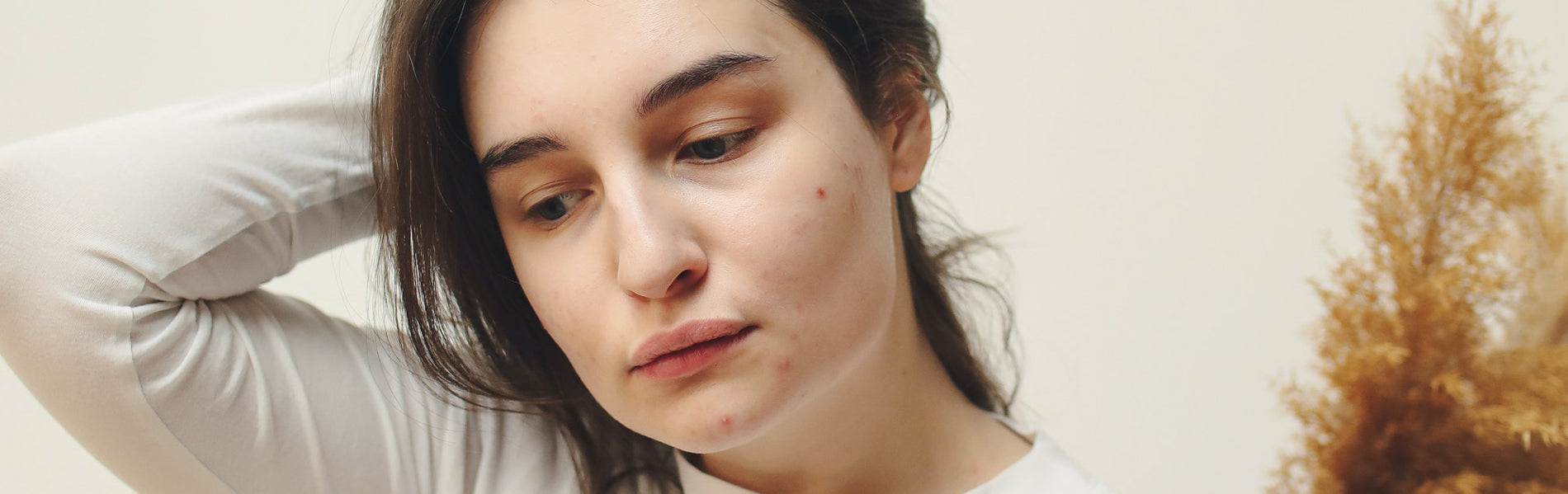 How to Identify and Treat Every Type of Acne