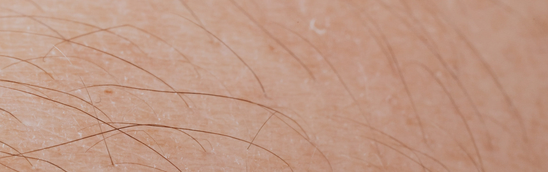 Is IPL hair removal safe?