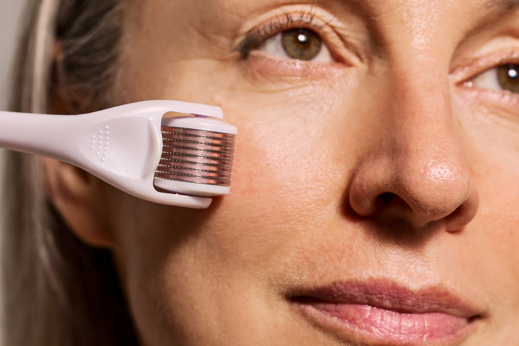 Microneedling | Project E Beauty