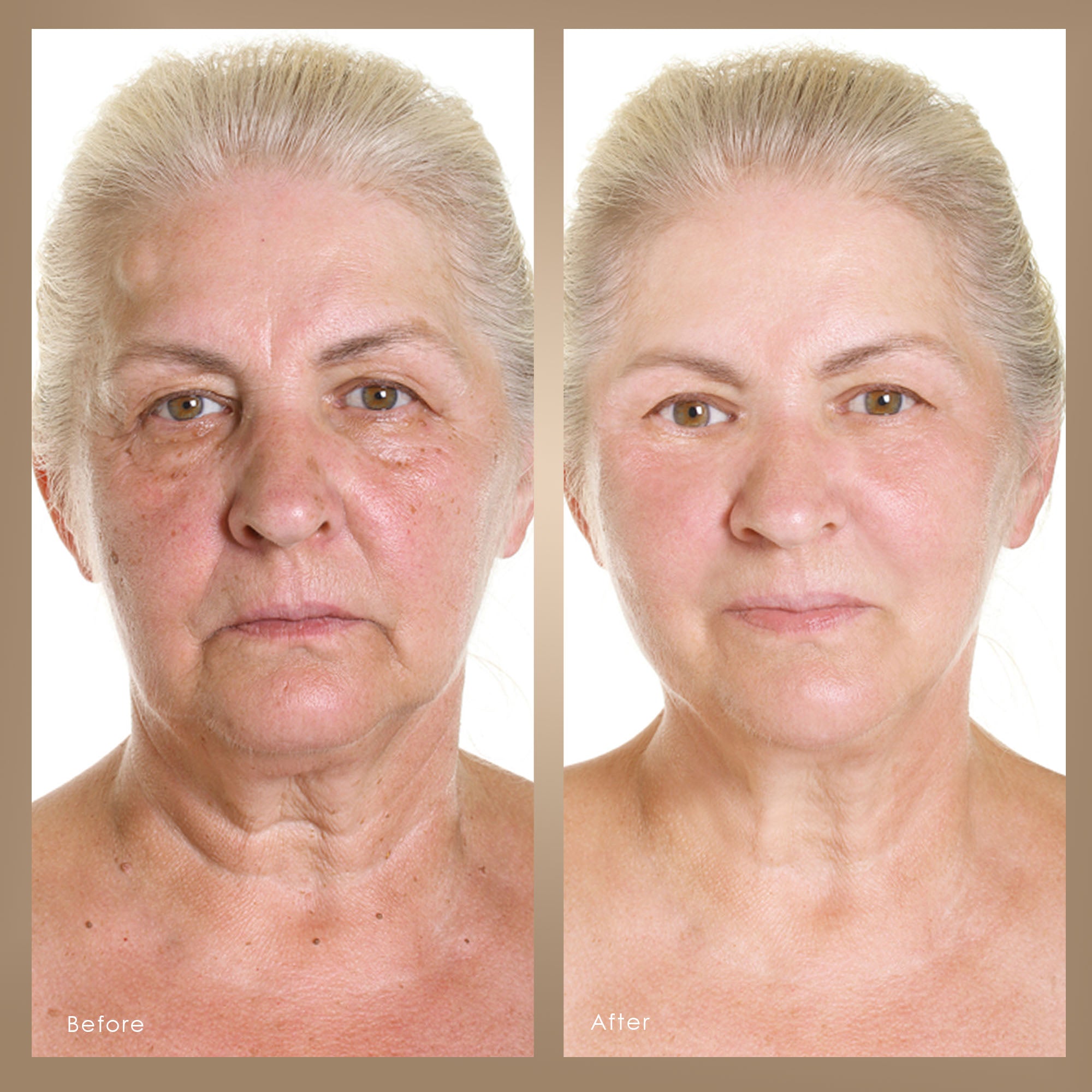 Photon Skin Rejuvenation Face & Neck Mask
