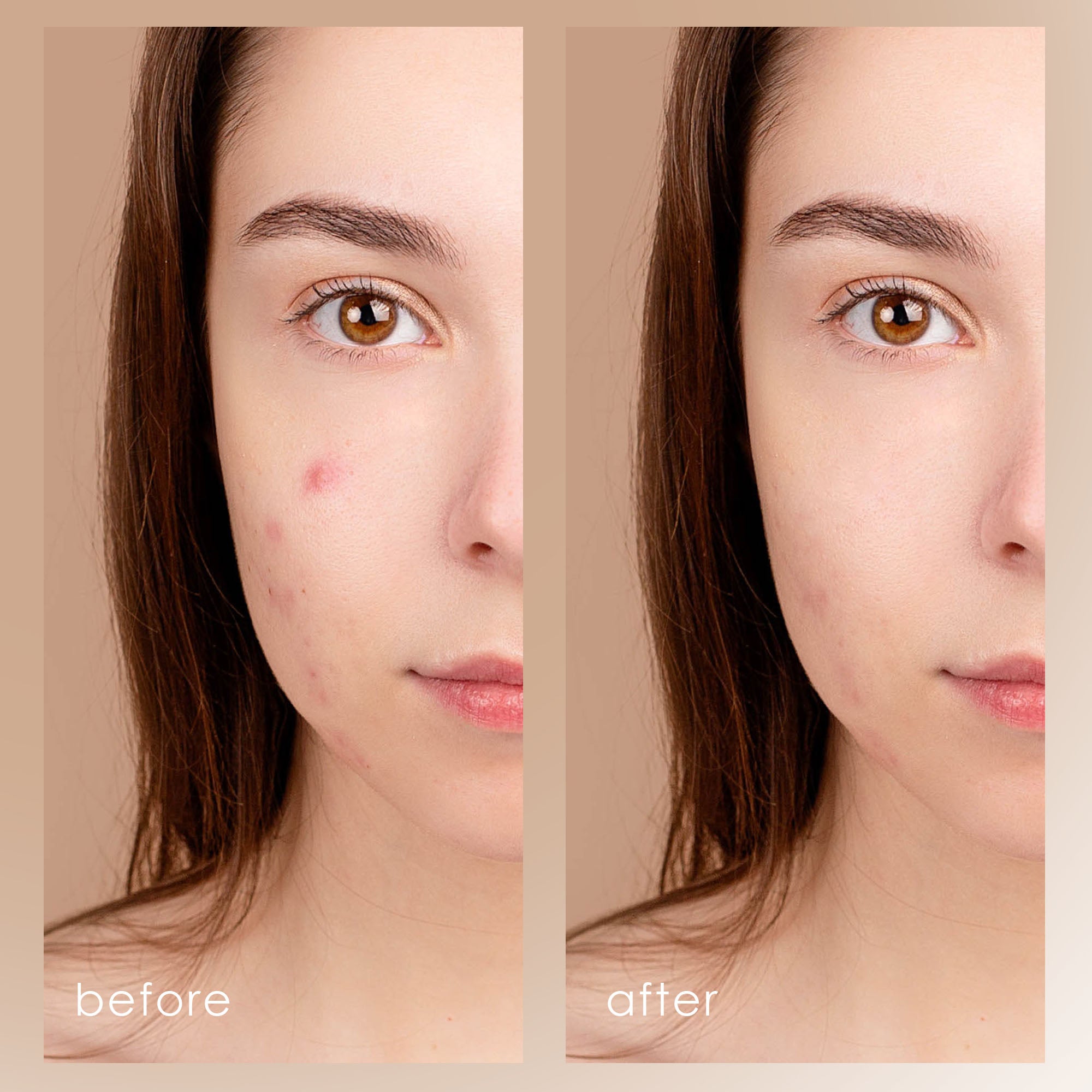 Project E Beauty Clear Care Anti-Acne Essence